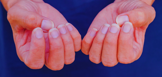 Strengthen weak nails by using natural recipes (1) تقوية الأظافر الضعيفة من خلال استخدام وصفات طبيعية