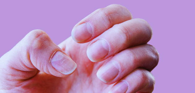 Strengthen weak nails through nutrition تقوية الأظافر الضعيفة من خلال التغذية