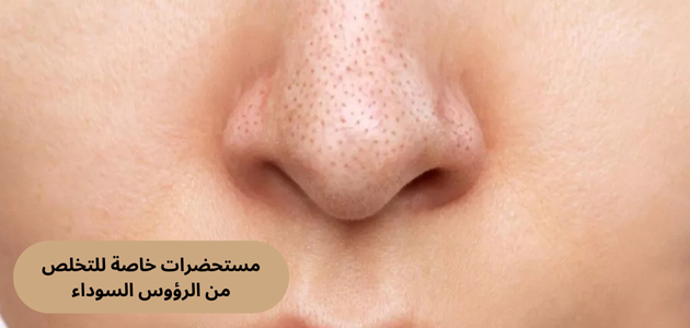 مستحضرات خاصة للتخلص من الرؤوس السوداء