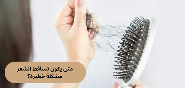 متى يكون تساقط الشعر مشكلة خطيرة؟