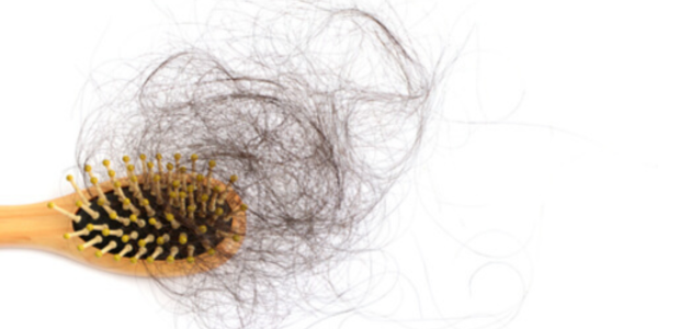 تساقط الشعر الشديد