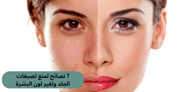 7 نصائح لمنع تصبغات الجلد وتغير لون البشرة