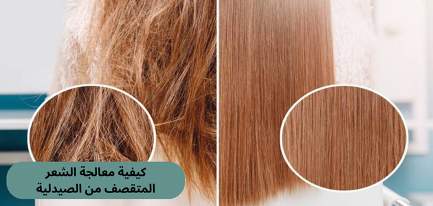 كيفية معالجة الشعر المتقصف من الصيدلية